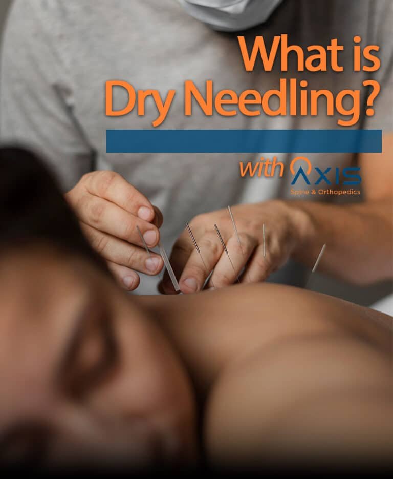 Dry needling