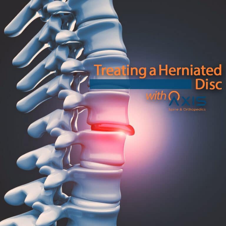 Herniated Disc