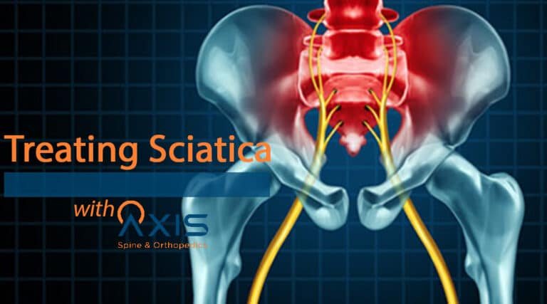 Treating Sciatica
