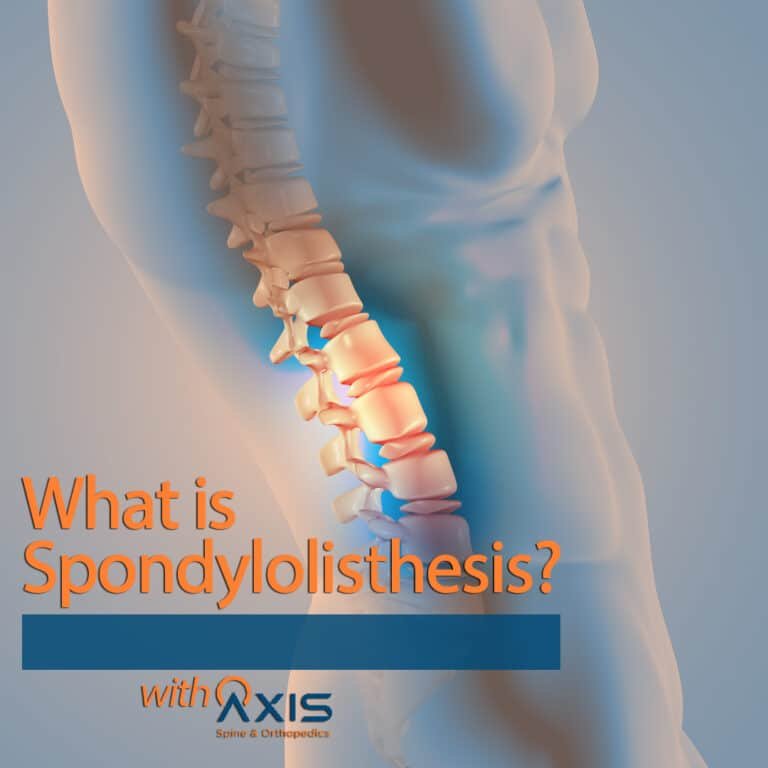 Spondylolisthesis