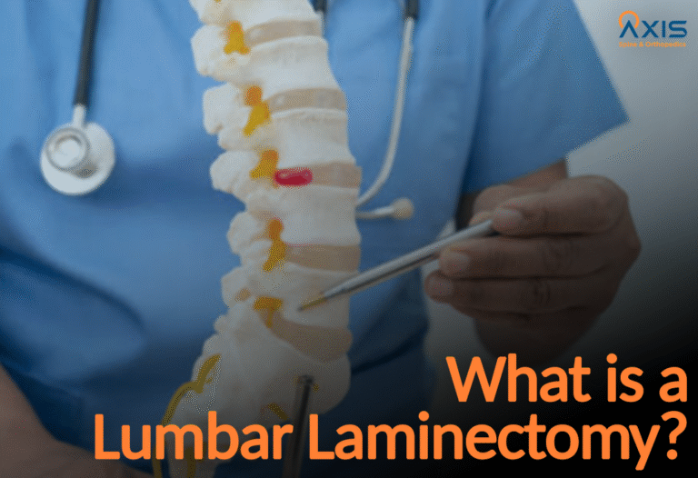 Lumbar Laminectomy