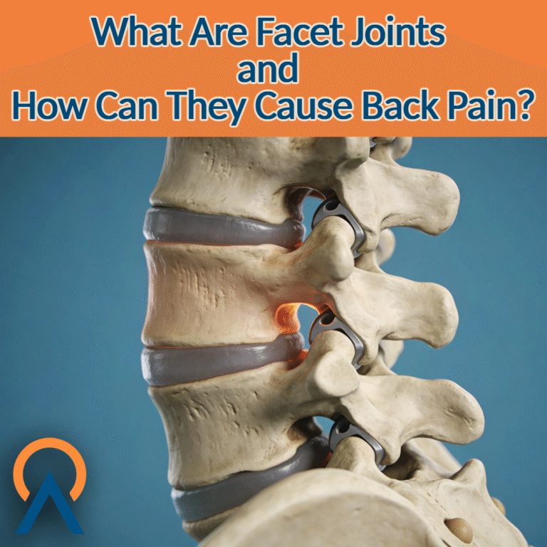 What are Facet Joints