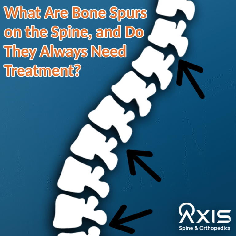 Bone spurs